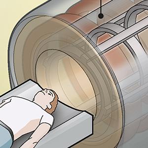 MRI scan